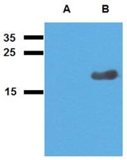 WB analysis of cell lysate of non-transfected E. coli (Lane1), cell lysate of Acr2-transfected E. coli (Lane2) using Acr2 antibody