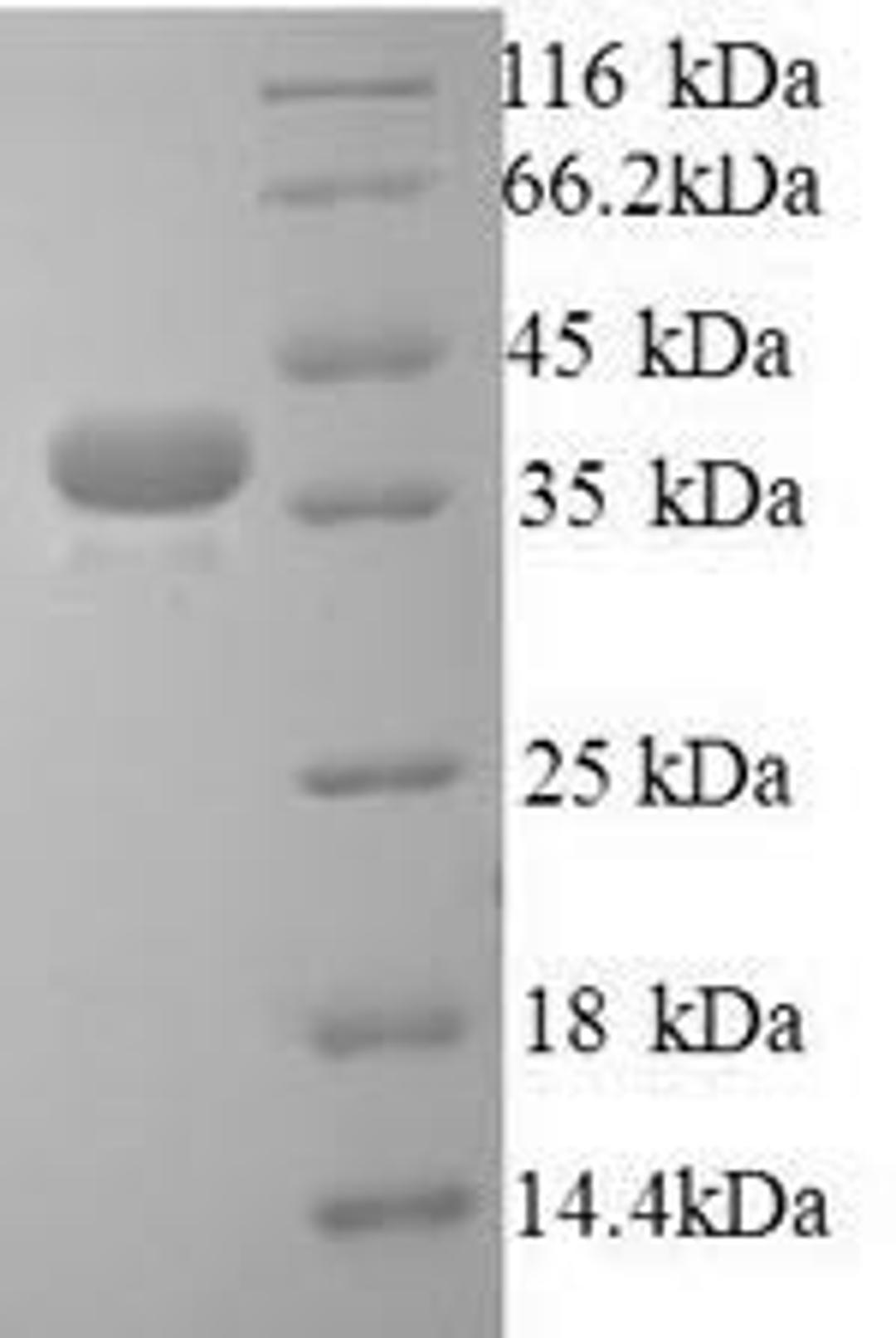(Tris-Glycine gel) Discontinuous SDS-PAGE (reduced) with 5% enrichment gel and 15% separation gel.
