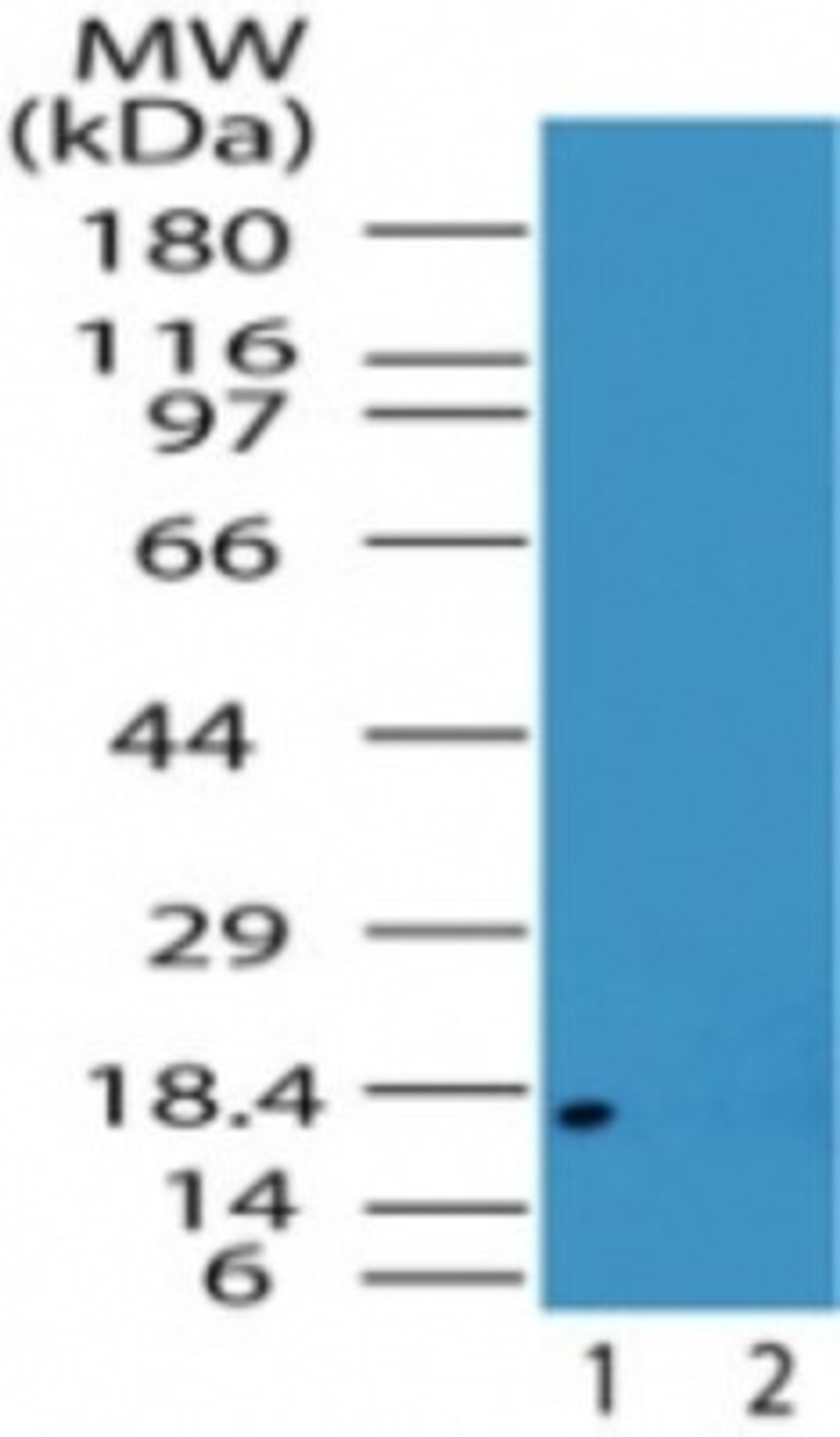 Western Blot: ACP1, Isoform B Antibody [NB100-56477] - analysis of ACP1 beta antibody in the 1) absence and 2) presence of immunizing peptide in human liver lysate using ACP1 beta antibody at 1 ug/ml.