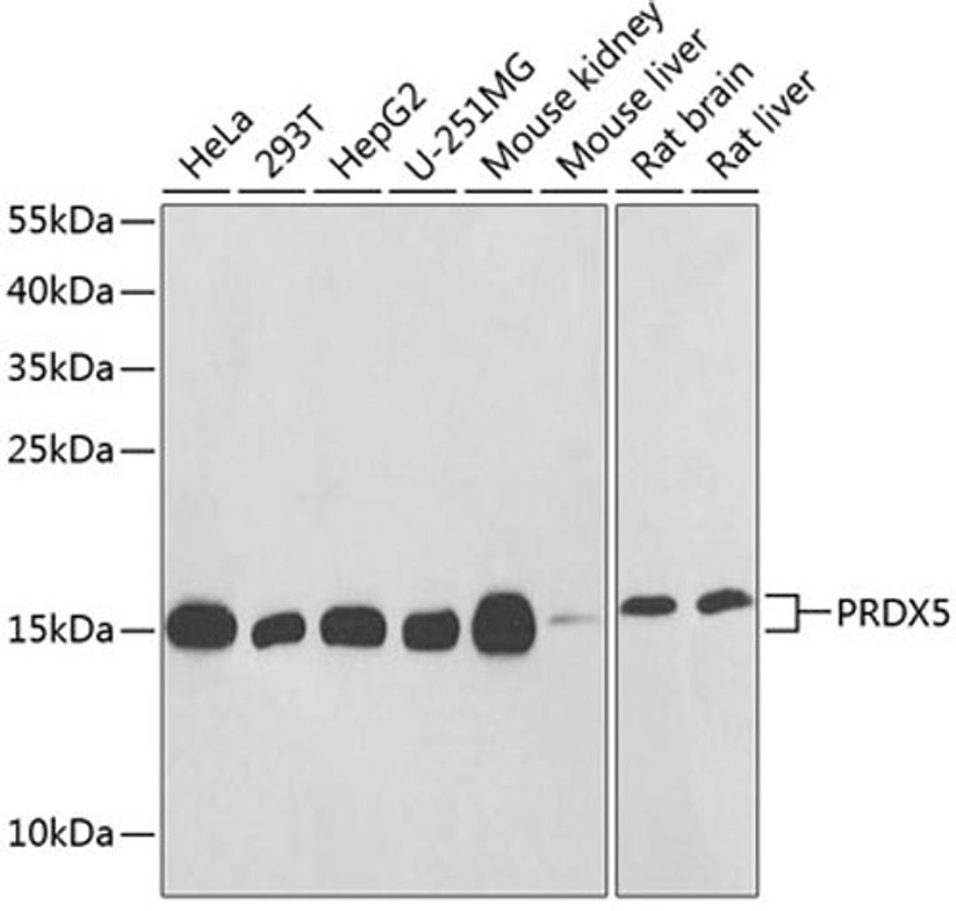 Western blot - PRDX5 antibody (A1269)