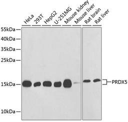 Western blot - PRDX5 antibody (A1269)