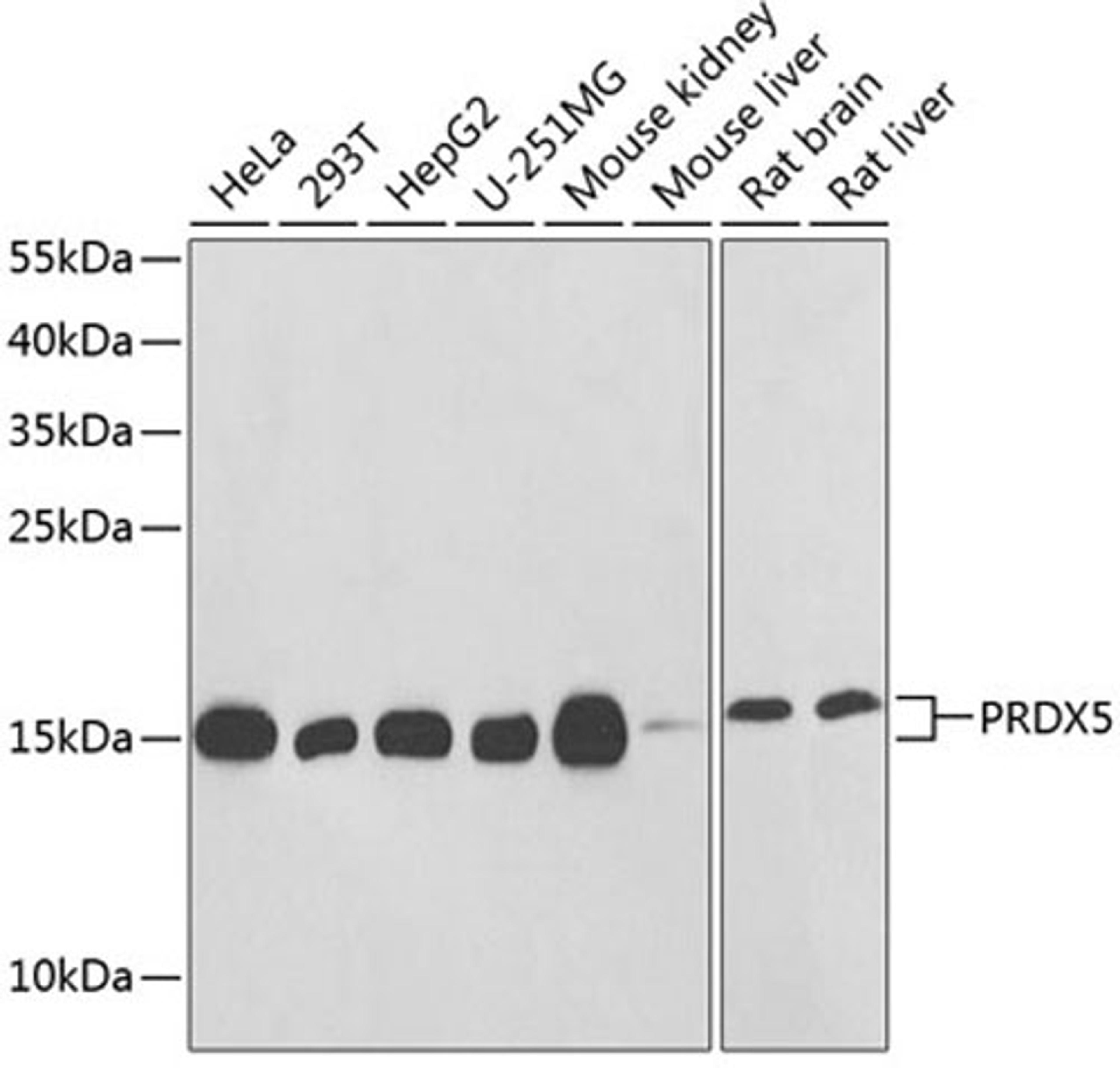 Western blot - PRDX5 antibody (A1269)