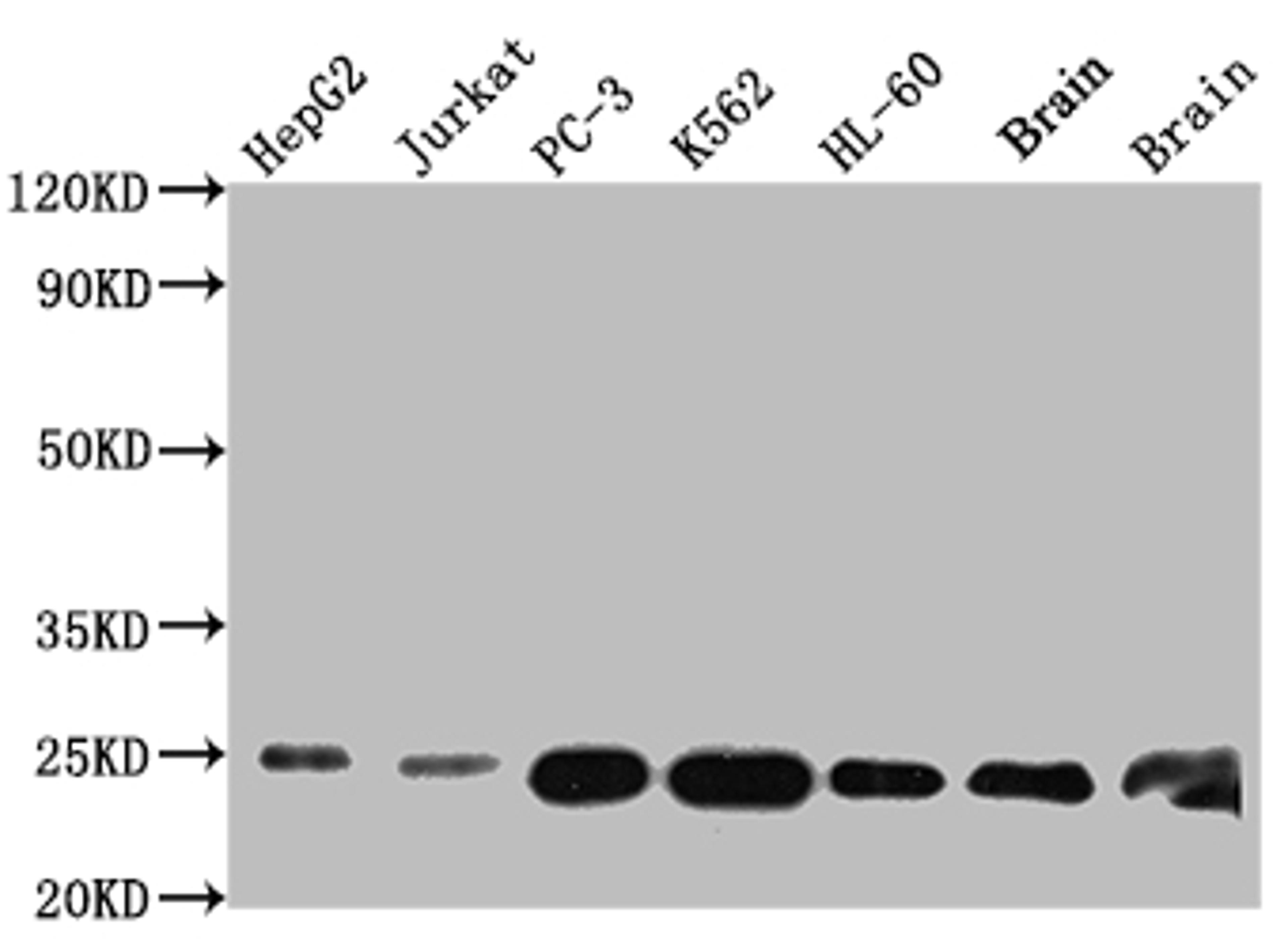 Western Blot. Positive WB detected in: HepG2 whole cell lysate, Jurkat whole cell lysate, PC-3 whole cell lysate, K562 whole cell lysate, HL-60 whole cell lysate, Mouse Brain whole cell lysate, Rat Brain whole cell lysate. All lanes: GSTP1 antibody at 1:1000. Secondary. Goat polyclonal to rabbit IgG at 1/50000 dilution. Predicted band size: 24 kDa. Observed band size: 24 kDa.