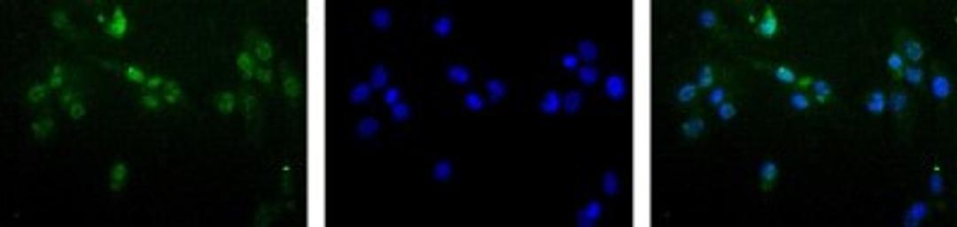 Immunocytochemistry/Immunofluorescence: MGMT Antibody (MT 23.2) [NB100-168] - Detection of MGMT (Green) in Hela cells using NB100-168 at a 1:50 dilution. Nuclei (Blue) are counterstained using Hoechst 33258.