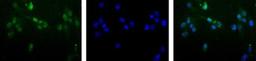 Immunocytochemistry/Immunofluorescence: MGMT Antibody (MT 23.2) [NB100-168] - Detection of MGMT (Green) in Hela cells using NB100-168 at a 1:50 dilution. Nuclei (Blue) are counterstained using Hoechst 33258.