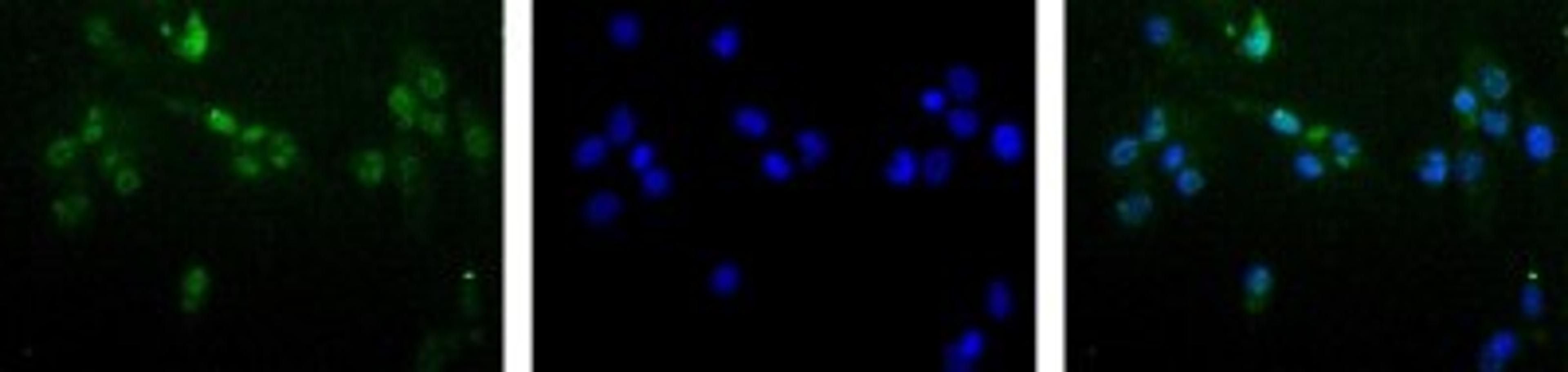 Immunocytochemistry/Immunofluorescence: MGMT Antibody (MT 23.2) [NB100-168] - Detection of MGMT (Green) in Hela cells using NB100-168 at a 1:50 dilution. Nuclei (Blue) are counterstained using Hoechst 33258.