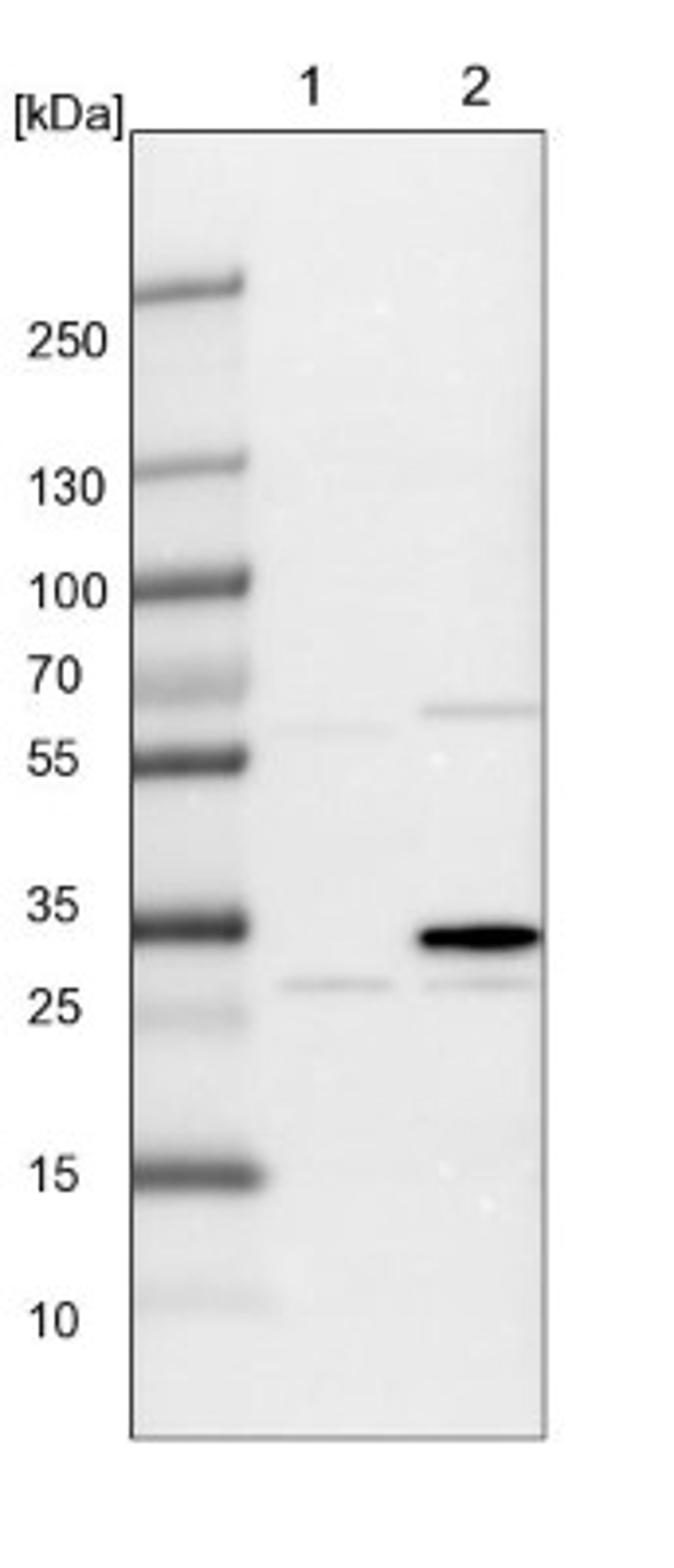 Western Blot: GPD1L Antibody [NBP1-87411] - Lane 1: Mouse liver tissue lysate<br/>Lane 2: Rat liver tissue lysate