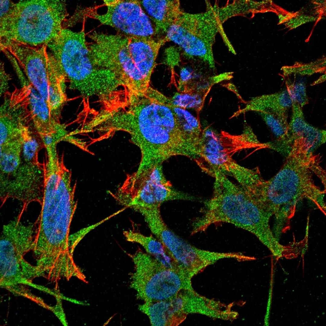 Immunofluorescence analysis of neuroblastoma cell line sk-n-be using NrCAM antibody