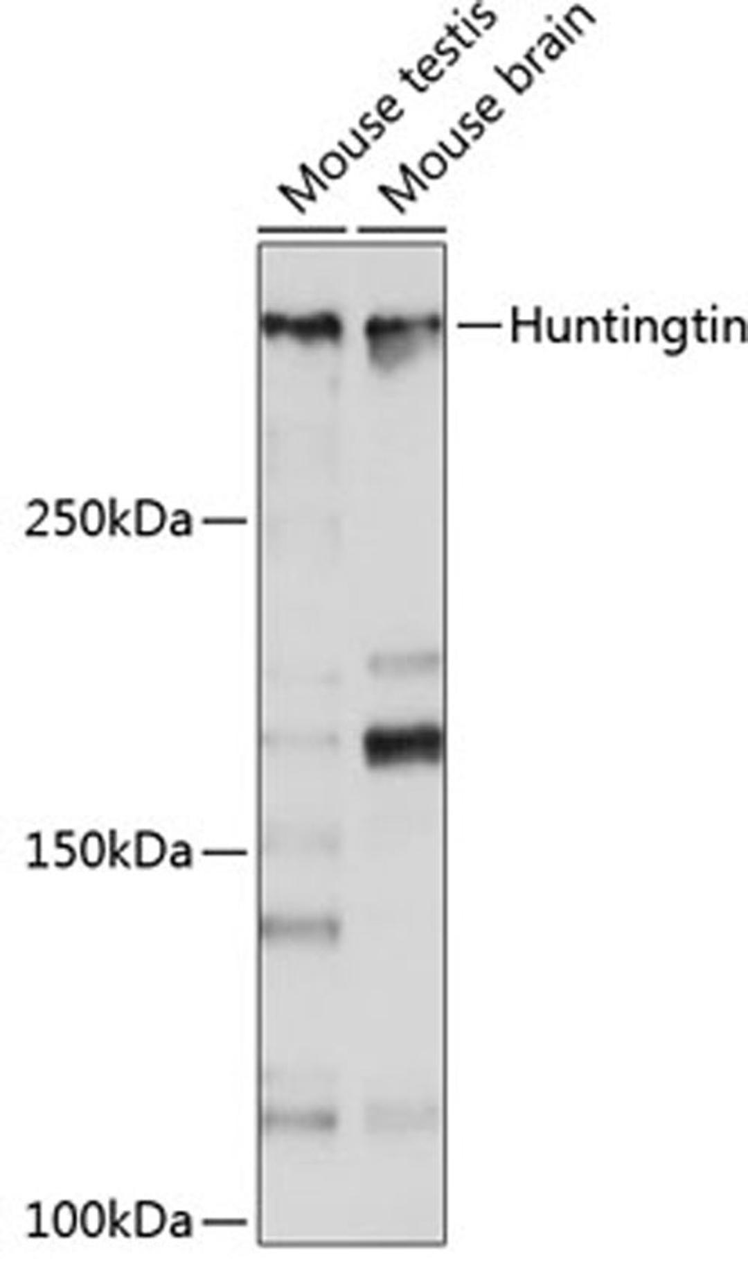 Western blot - Huntingtin antibody (A19064)