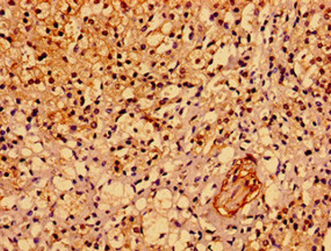 Immunohistochemistry of paraffin-embedded human adrenal gland tissue using CSB-PA814245LA01HU at dilution of 1:100