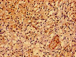 Immunohistochemistry of paraffin-embedded human adrenal gland tissue using CSB-PA814245LA01HU at dilution of 1:100