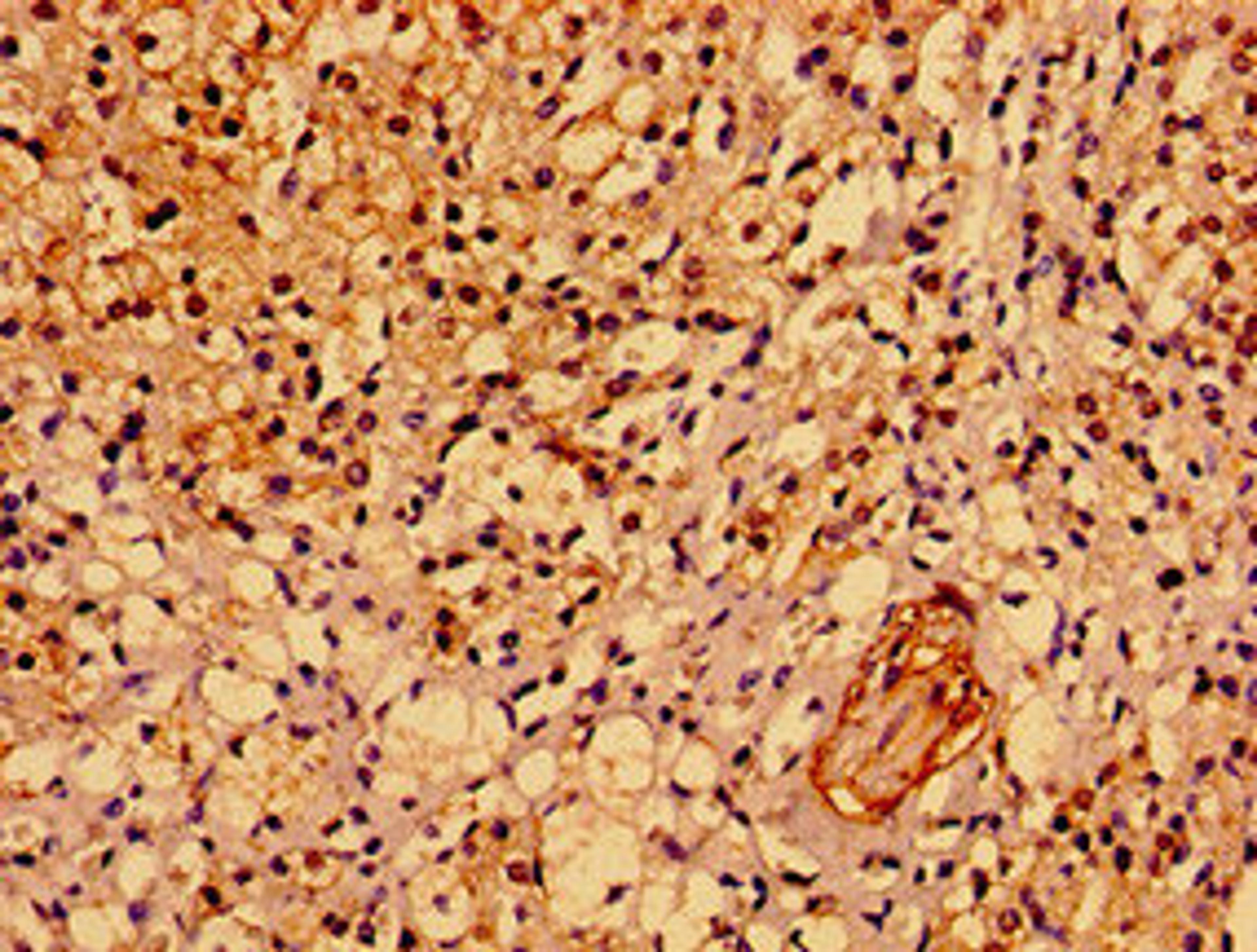 Immunohistochemistry of paraffin-embedded human adrenal gland tissue using CSB-PA814245LA01HU at dilution of 1:100