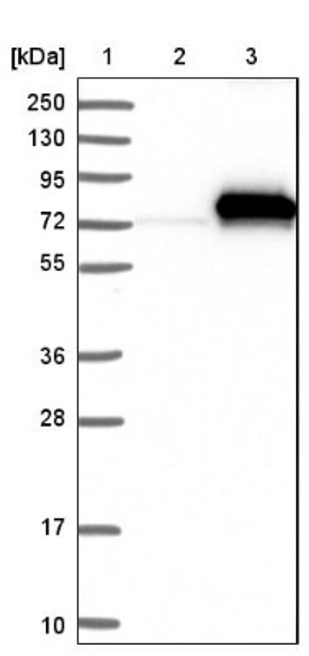 Western Blot: C4 binding protein A Antibody [NBP1-88262] - Lane 1: Marker [kDa] 250, 130, 95, 72, 55, 36, 28, 17, 10<br/>Lane 2: Negative control (vector only transfected HEK293T lysate)<br/>Lane 3: Over-expression lysate (Co-expressed with a C-terminal myc-DDK tag (~3.1 kDa) in mammalian HEK293T cells, LY424544)