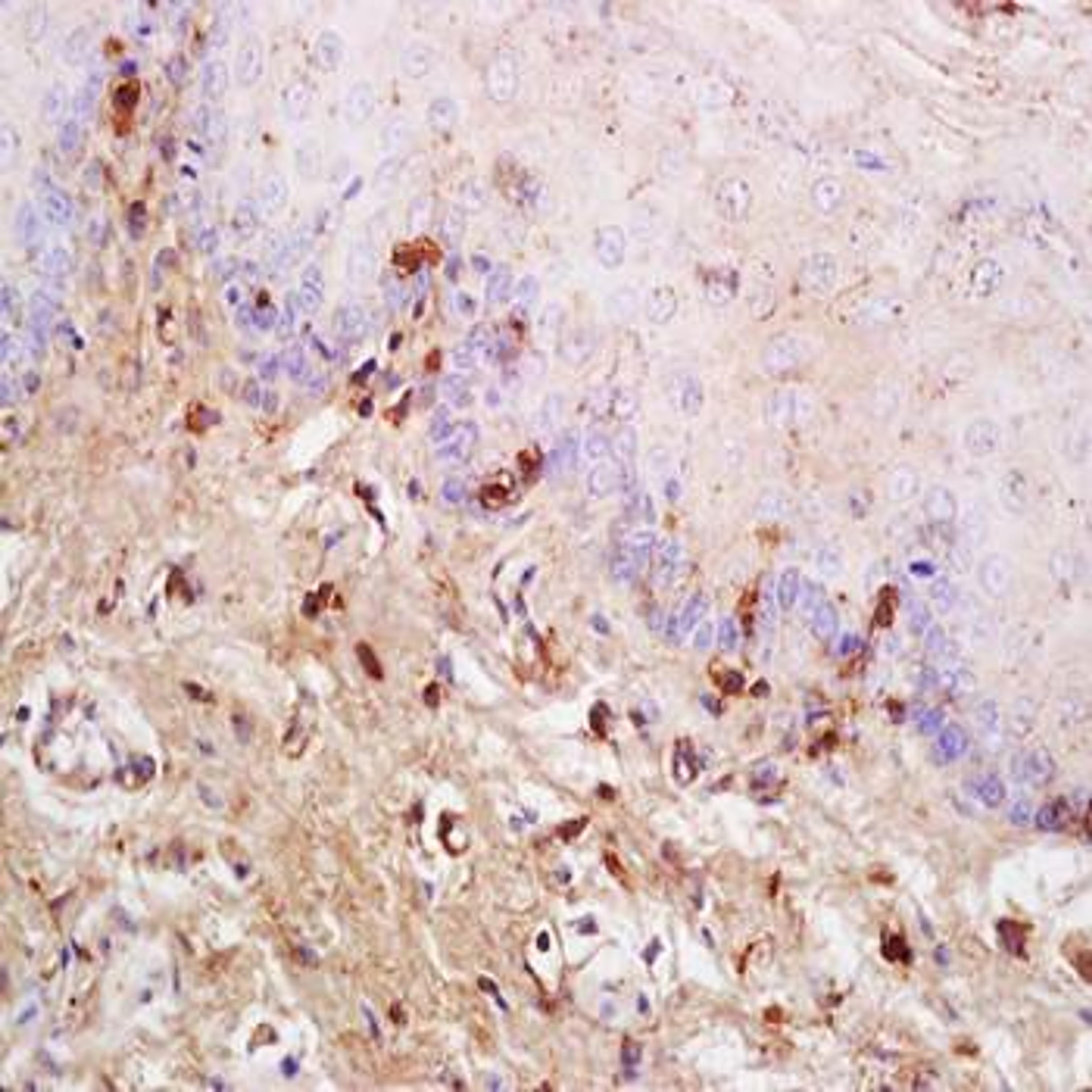 Immunohistochemical analysis of formalin-fixed and paraffin embedded rat tongue tissue (Dilution at:1:200) using CADM1 antibody