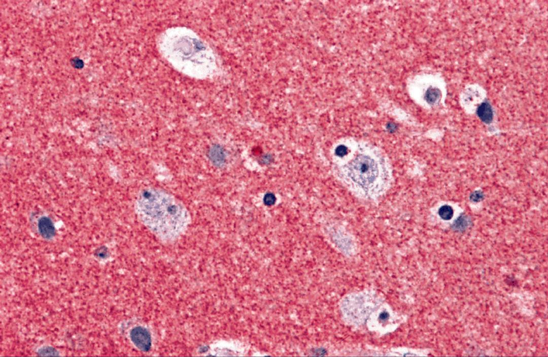 Immunohistochemistry of RIM2 in human brain tissue with RIM2 antibody at 5 μg/ml