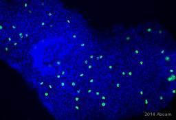 Immunocytochemistry/ Immunofluorescence - Anti-Histone H3 (phospho S28) antibody [HTA28] (ab10543)