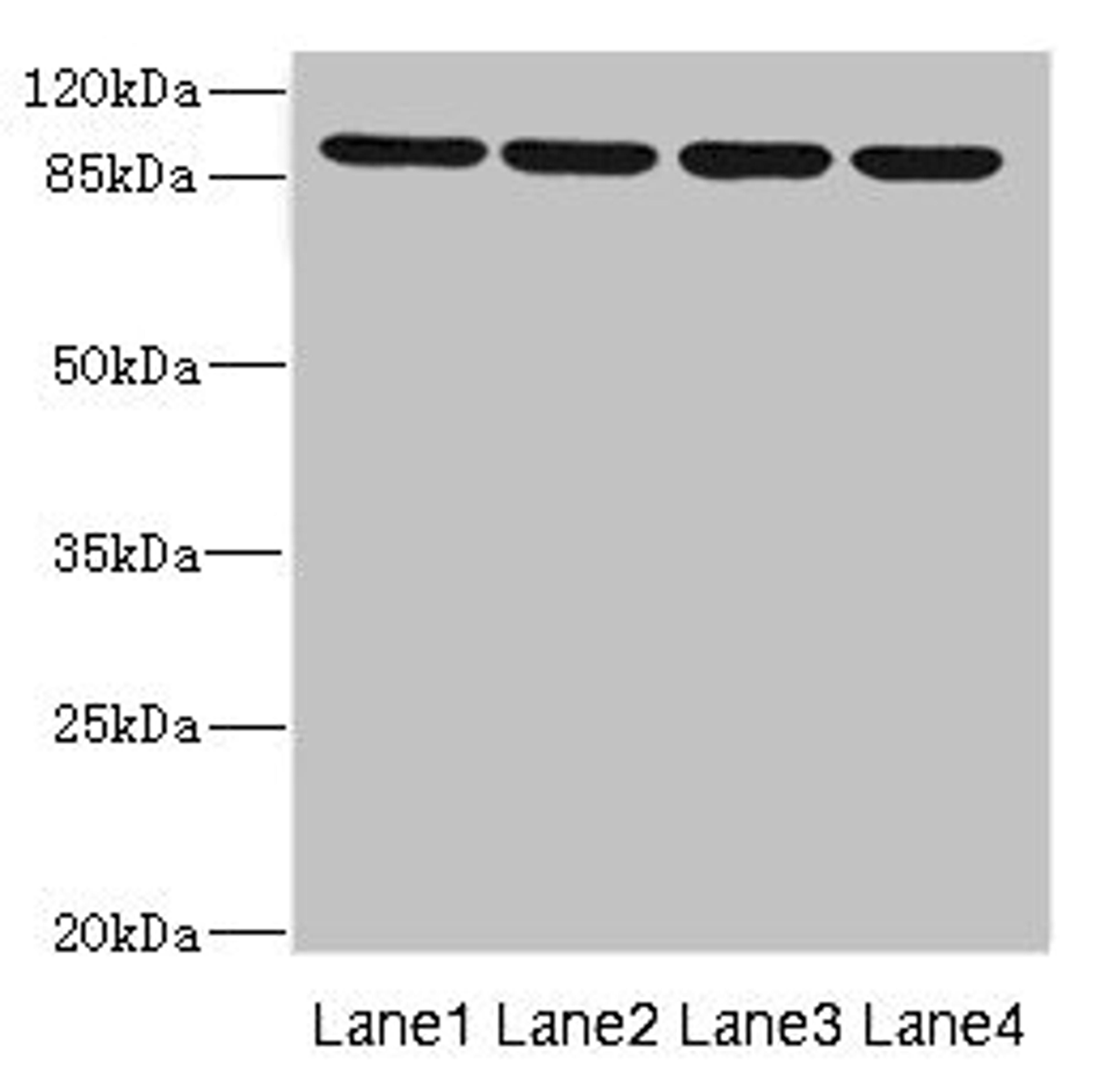 Western blot. All lanes: ITGB8 antibody at 1.52µg/ml. Lane 1: 293T whole cell lysate. Lane 2: Hela whole cell lysate. Lane 3: HepG2 whole cell lysate. Lane 4: A549 whole cell lysate. Secondary. Goat polyclonal to rabbit IgG at 1/10000 dilution. Predicted band size: 86, 72 kDa. Observed band size: 86 kDa