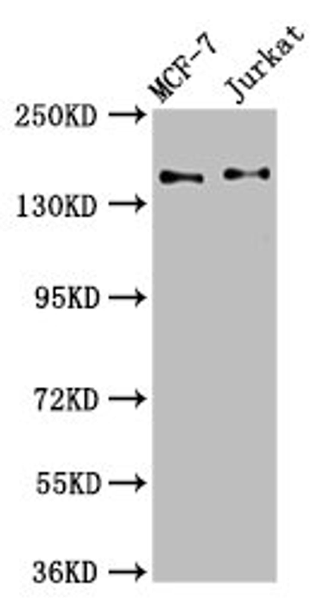 Western Blot. Positive WB detected in: MCF-7 whole cell lysate, Jurkat whole cell lysate. All lanes: KTN1 antibody at 3.4ug/ml. Secondary. Goat polyclonal to rabbit IgG at 1/50000 dilution. Predicted band size: 157, 150, 151, 153 kDa. Observed band size: 157 kDa. 