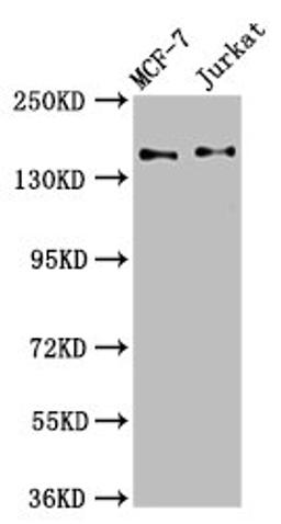 Western Blot. Positive WB detected in: MCF-7 whole cell lysate, Jurkat whole cell lysate. All lanes: KTN1 antibody at 3.4ug/ml. Secondary. Goat polyclonal to rabbit IgG at 1/50000 dilution. Predicted band size: 157, 150, 151, 153 kDa. Observed band size: 157 kDa. 