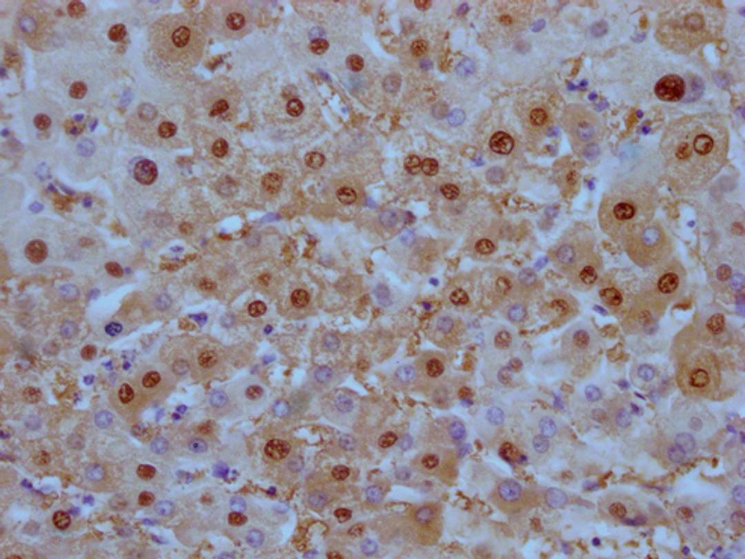IHC image of CSB-MA908650 diluted at 1:100 and staining in paraffin-embedded human liver tissue performed on a Leica BondTM system. After dewaxing and hydration, antigen retrieval was mediated by high pressure in a citrate buffer (pH 6.0). Section was blocked with 10% normal goat serum 30min at RT. Then primary antibody (1% BSA) was incubated at 4°C overnight. The primary is detected by a Goat anti-mouse IgG polymer labeled by HRP and visualized using 0.05% DAB.