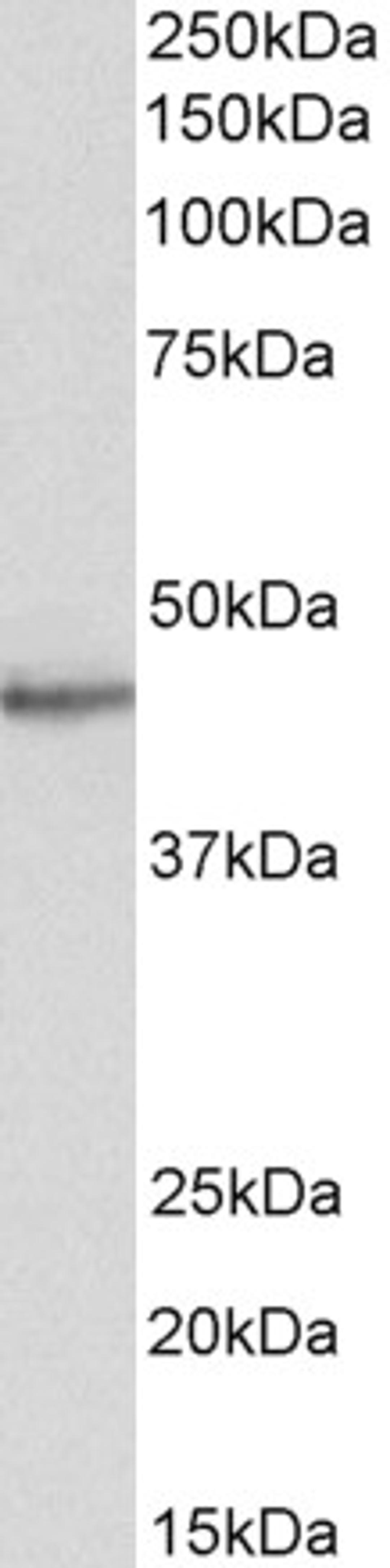 46-439 (0.5ug/ml) staining of Human Heart lysate (35ug protein in RIPA buffer). Primary incubation was 1 hour. Detected by chemiluminescence.