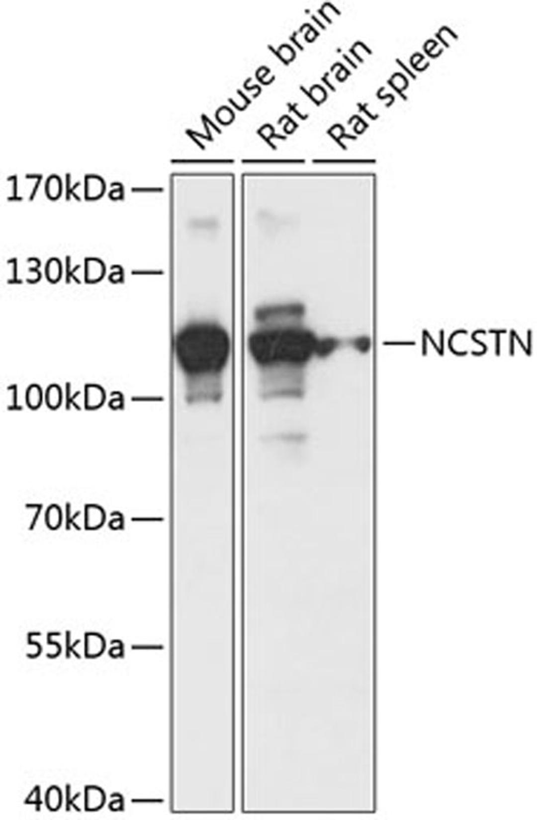 Western blot - NCSTN antibody (A14505)