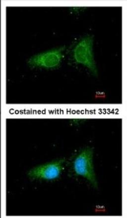 Immunocytochemistry/Immunofluorescence: beta COP Antibody [NBP2-15578] - Immunofluorescence analysis of methanol-fixed HeLa, using antibody at 1:100 dilution.