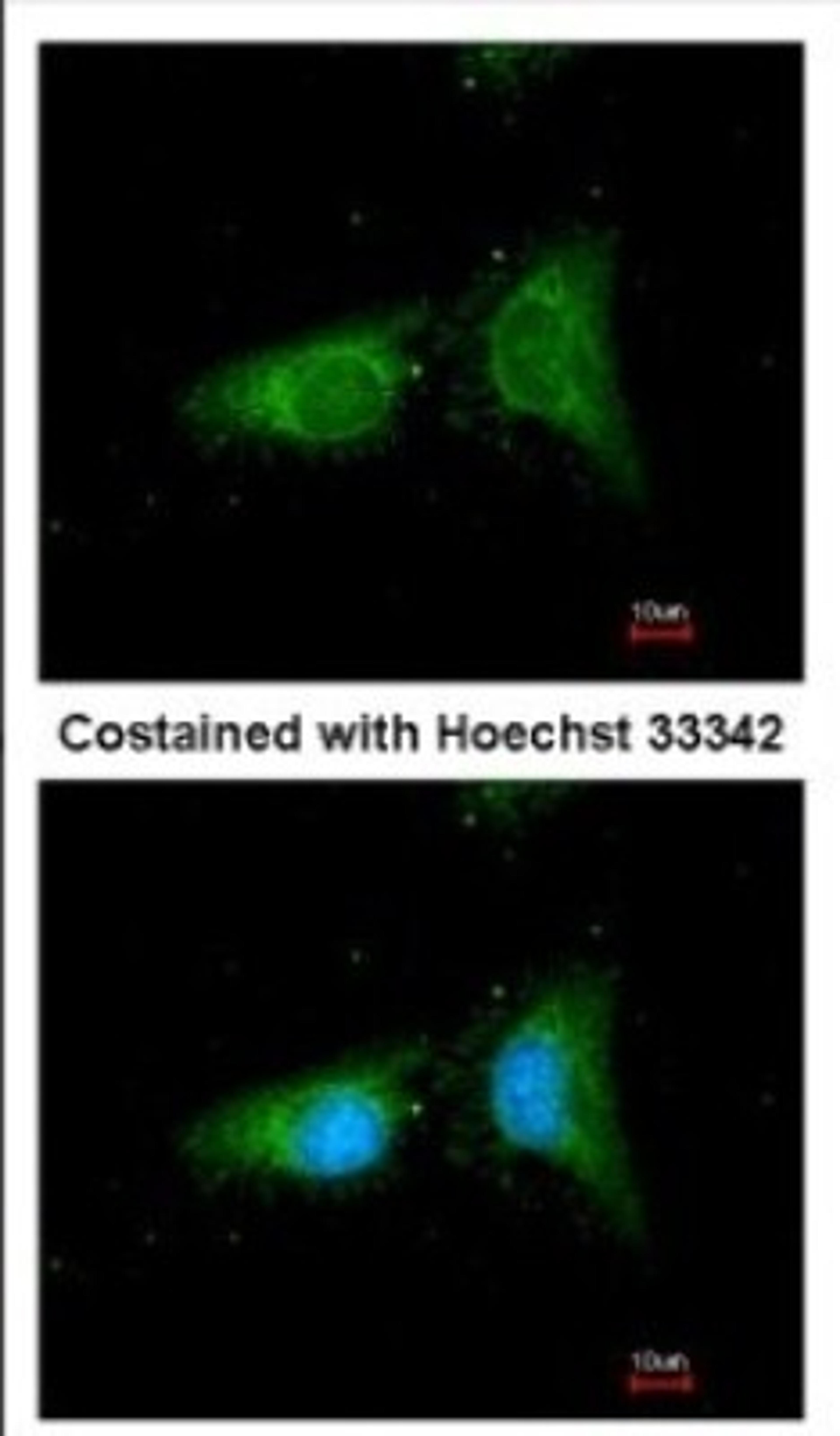 Immunocytochemistry/Immunofluorescence: beta COP Antibody [NBP2-15578] - Immunofluorescence analysis of methanol-fixed HeLa, using antibody at 1:100 dilution.