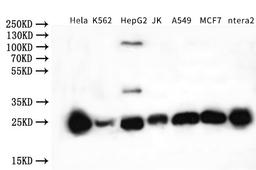 Western Blot. Positive WB detected in: K562 whole cell lysate, Mouse liver tissue. All lanes: NQO2 antibody at 3ug/ml. Secondary. Goat polyclonal to rabbit IgG at 1/50000 dilution. Predicted band size: 26 kDa. Observed band size: 26 kDa. 