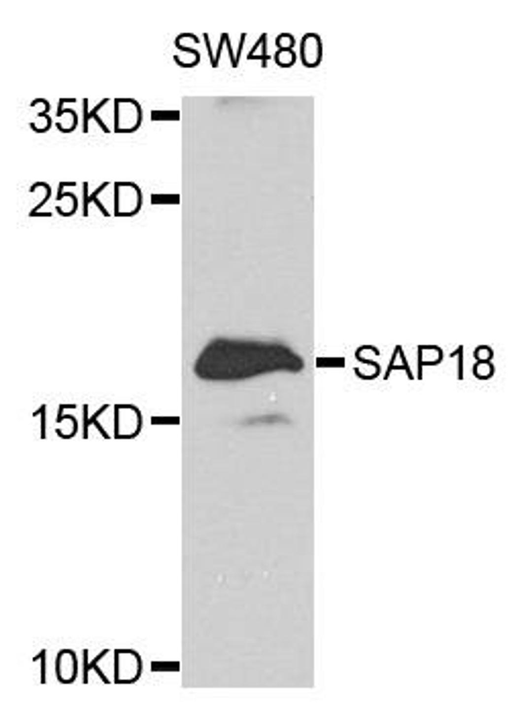 Western blot analysis of extract of various cells using SAP18 antibody