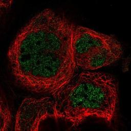 Immunocytochemistry/Immunofluorescence: RABGGTA Antibody [NBP1-87197] - Staining of human cell line A-431 shows positivity in nucleus but not nucleoli.