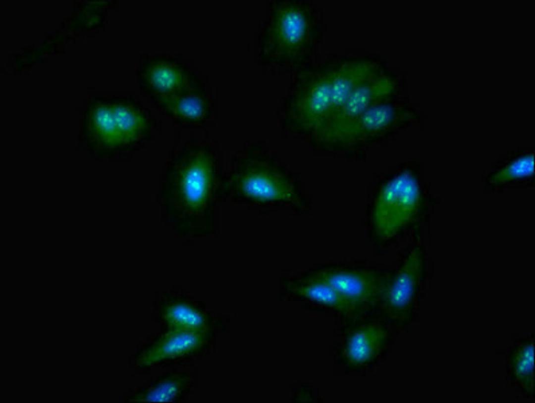 Immunofluorescent analysis of Hela cells using CSB-PA896703LA01HU at dilution of 1:100 and Alexa Fluor 488-congugated AffiniPure Goat Anti-Rabbit IgG(H+L)