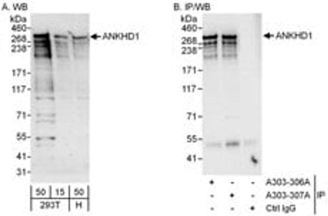 Detection of human ANKHD1 by western blot and immunoprecipitation.