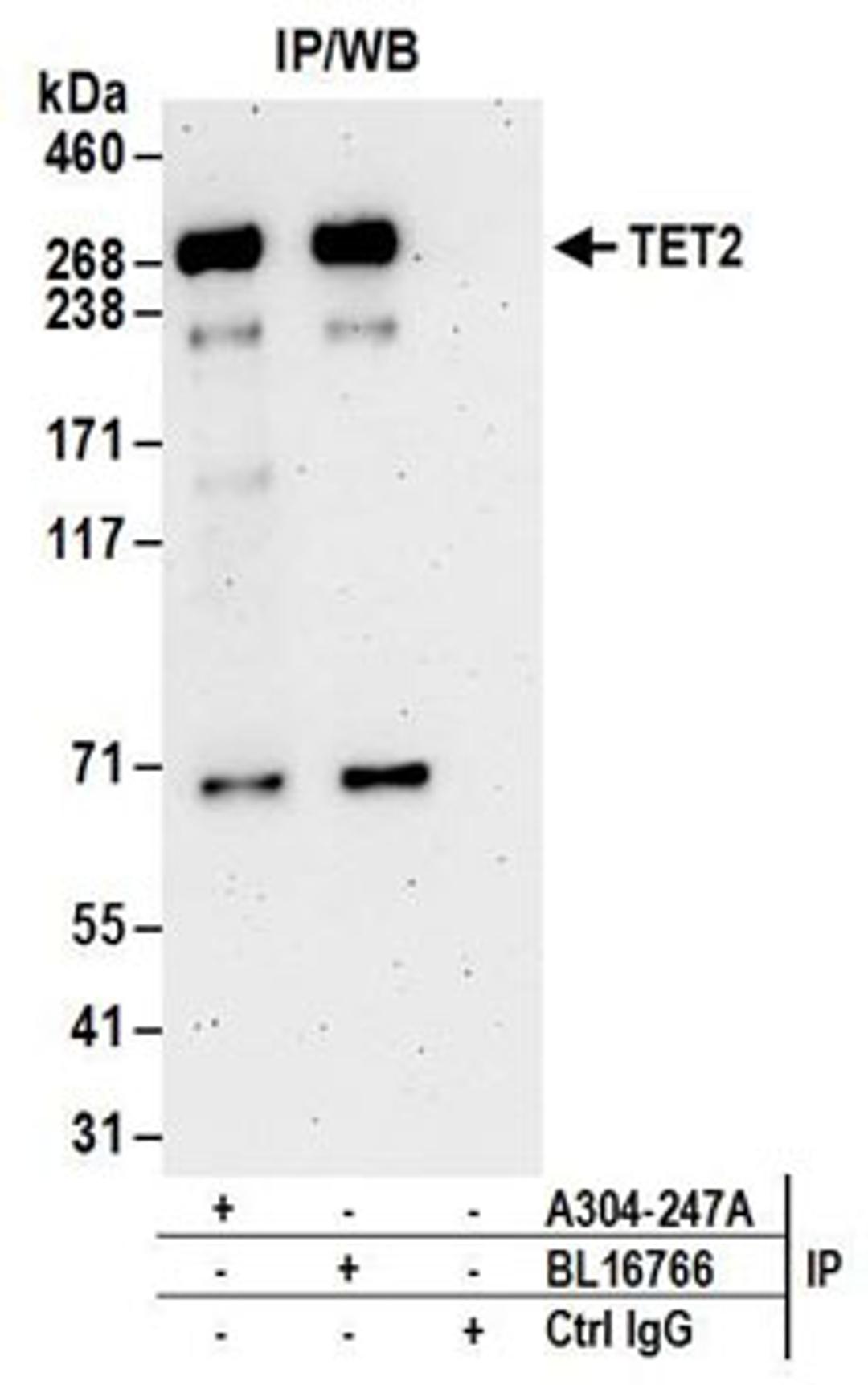 Detection of human TET2 by western blot of immunoprecipitates.