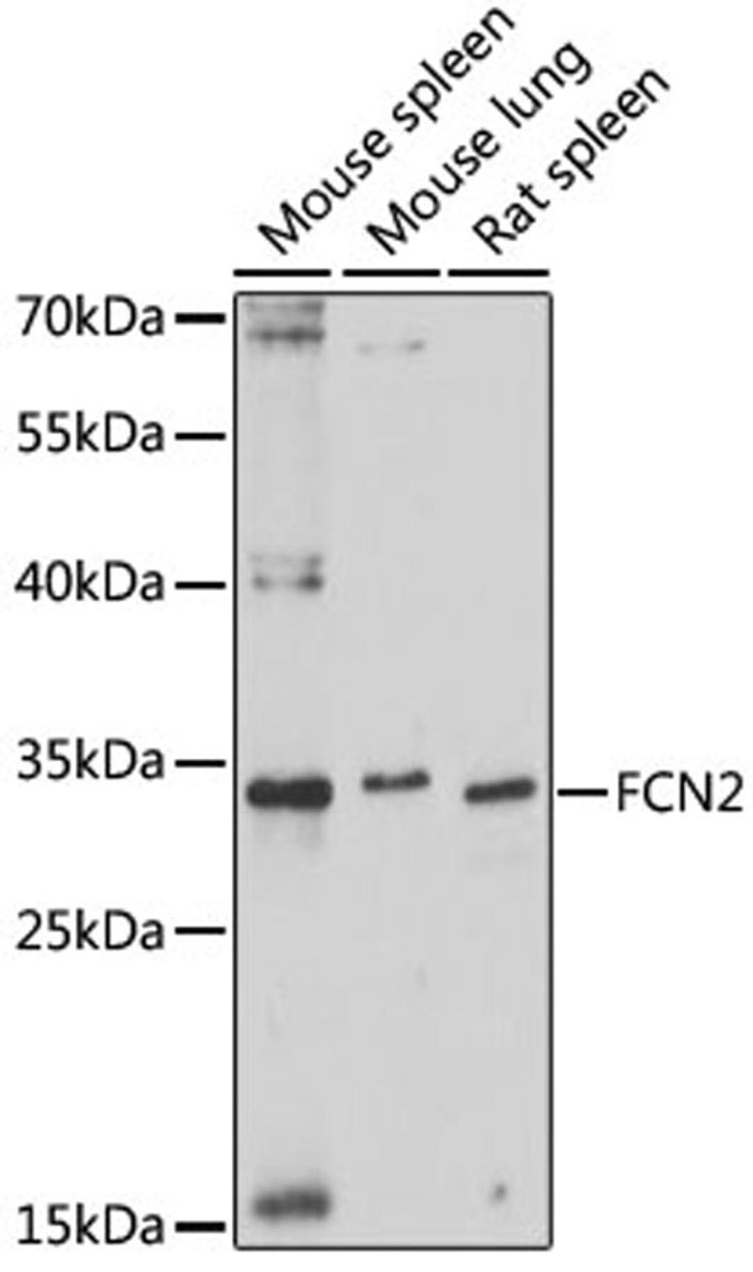 Western blot - FCN2 antibody (A16690)