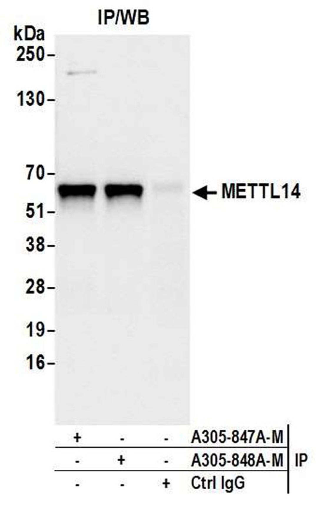 Detection of human METTL14 by WB of IP.