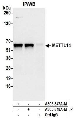 Detection of human METTL14 by WB of IP.