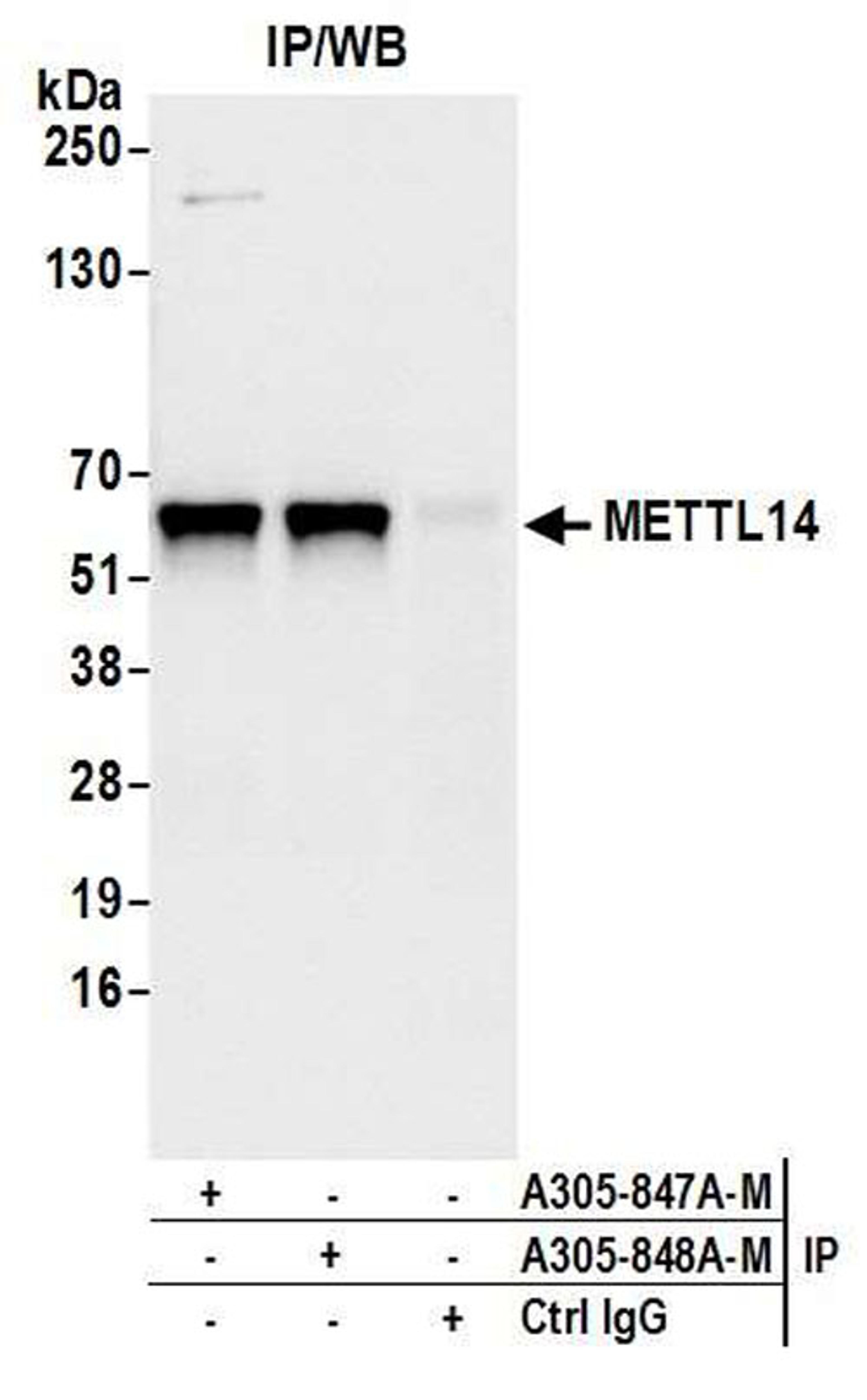 Detection of human METTL14 by WB of IP.