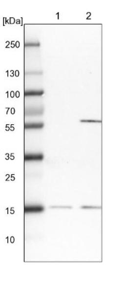 Western Blot: Arginine decarboxylase Antibody [NBP1-82879] - Lane 1: NIH-3T3 cell lysate (Mouse embryonic fibroblast cells)<br/>Lane 2: NBT-II cell lysate (Rat Wistar bladder tumour cells)