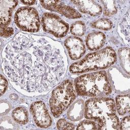 Immunohistochemistry: KATNBL1 Antibody [NBP2-31859] - Staining of human kidney shows strong cytoplasmic positivity in cells in tubules.