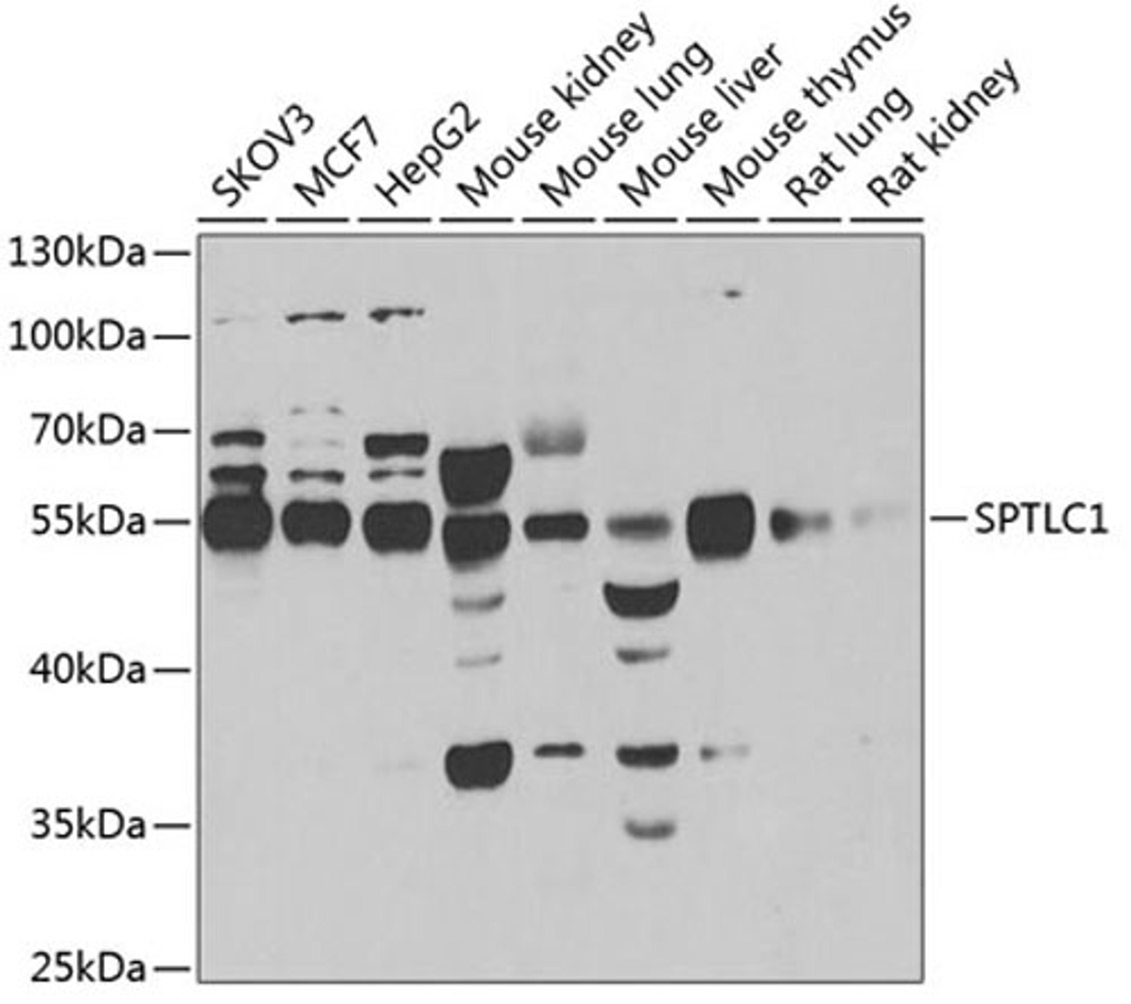 Western blot - SPTLC1 antibody (A6750)