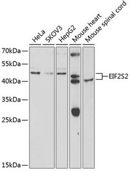 Western blot - EIF2S2 antibody (A5894)