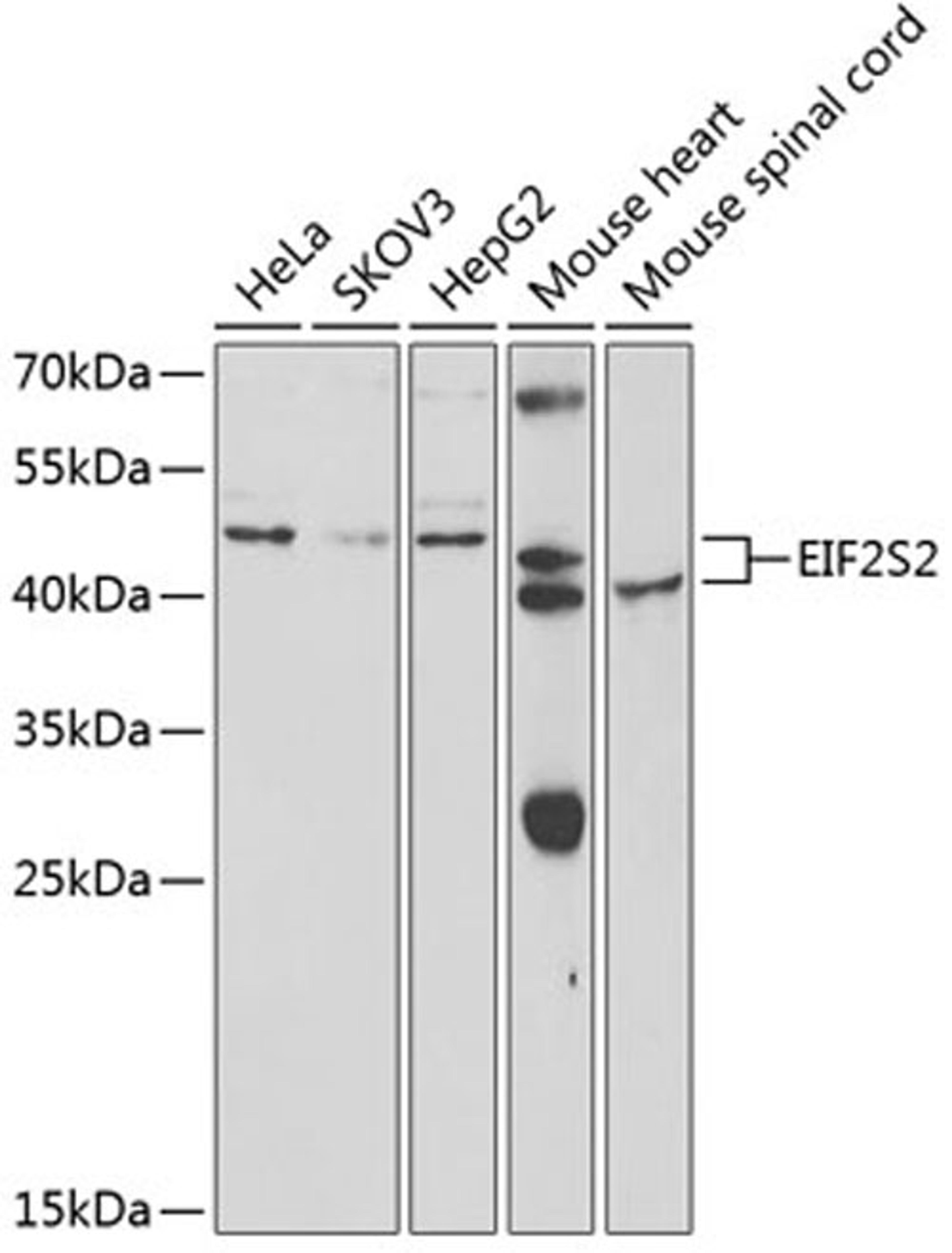 Western blot - EIF2S2 antibody (A5894)