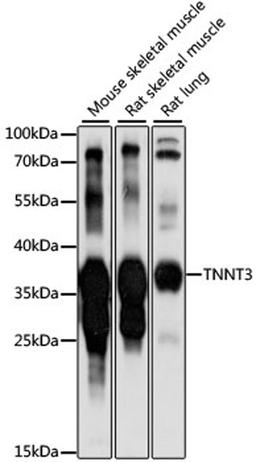 Western blot - TNNT3 antibody (A15323)