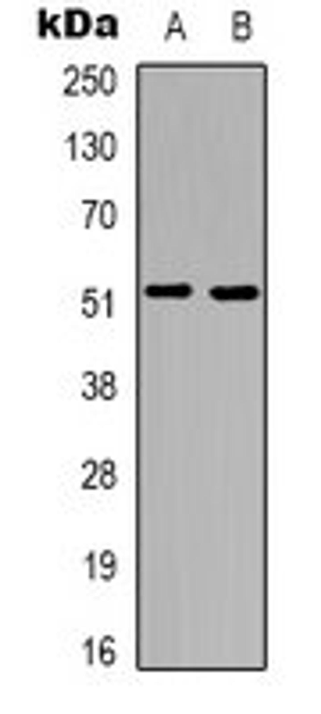 Western blot analysis of A549 (Lane 1), COLO205 (Lane 2) whole cell lysates using Tachykinin Receptor 3 antibody