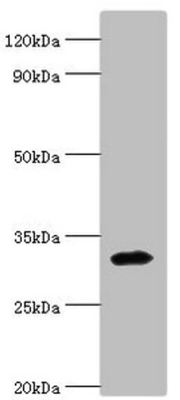 Western blot. All lanes: Zinc finger protein 346 antibody at 3ug/ml + Mouse brain tissue. Secondary. Goat polyclonal to rabbit IgG at 1/10000 dilution. Predicted band size: 33, 36, 30 kDa. Observed band size: 33 kDa. 