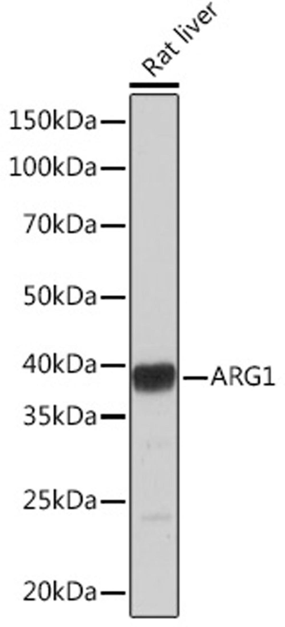 Western blot - ARG1 Rabbit mAb (A4923)