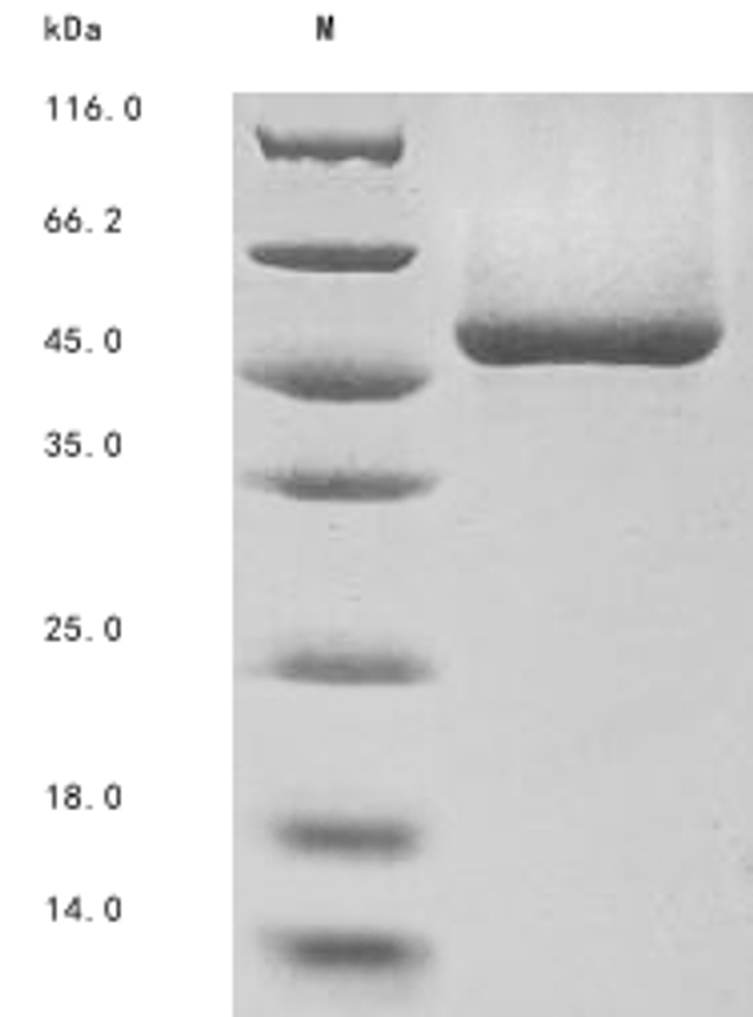 (Tris-Glycine gel) Discontinuous SDS-PAGE (reduced) with 5% enrichment gel and 15% separation gel.