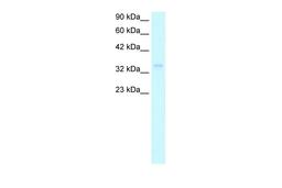 Antibody used in WB on Human HepG2 at 1 ug/ml.