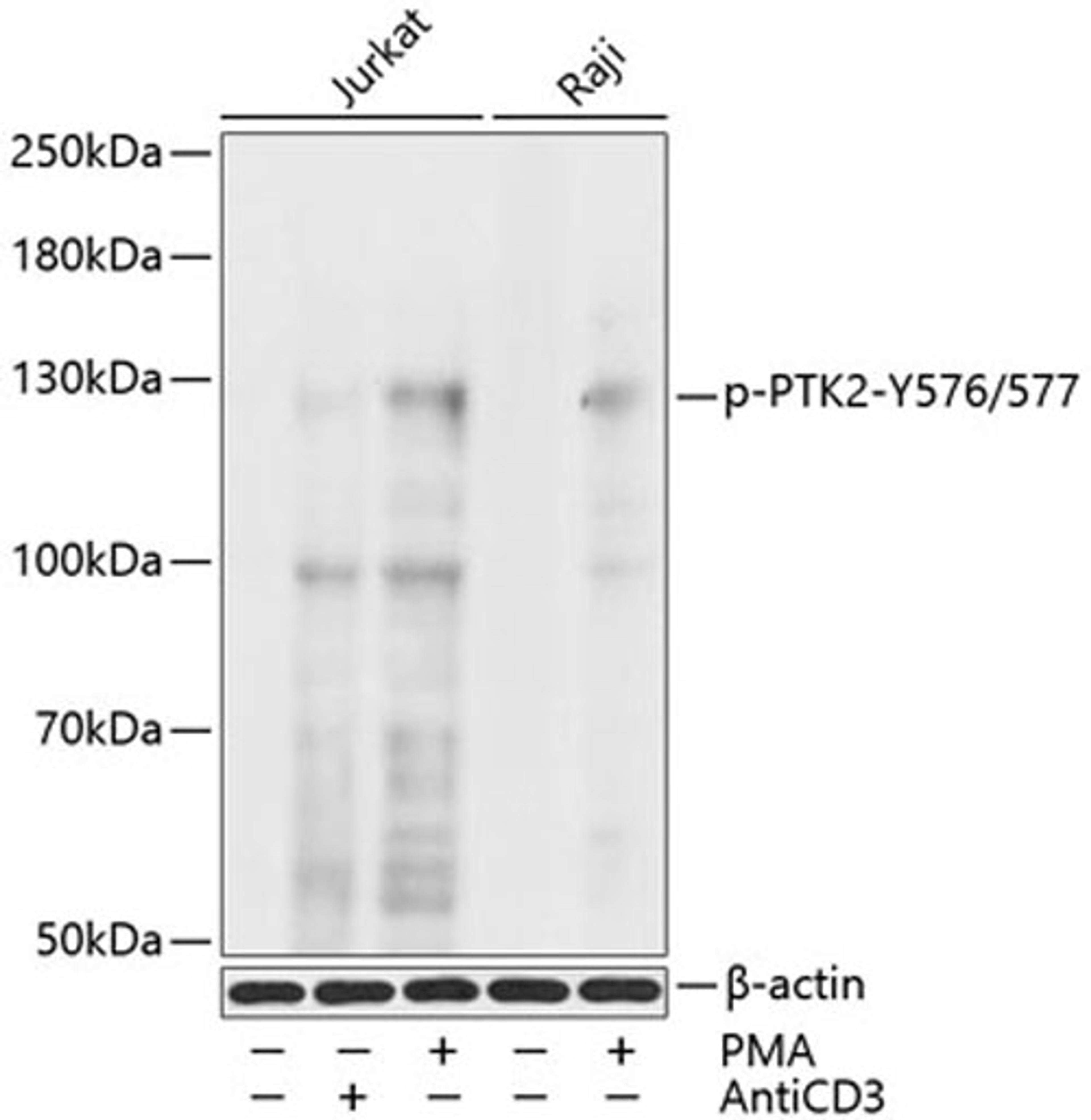 Western blot - Phospho-PTK2-Y576/577 antibody (AP0536)